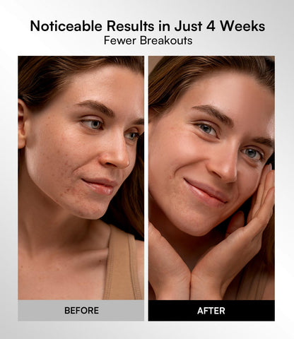 Transform Your Skin with the INIA Red Light Therapy Mask - 4 Modes of Healing Power, Visible Results in Just 4 Weeks!
