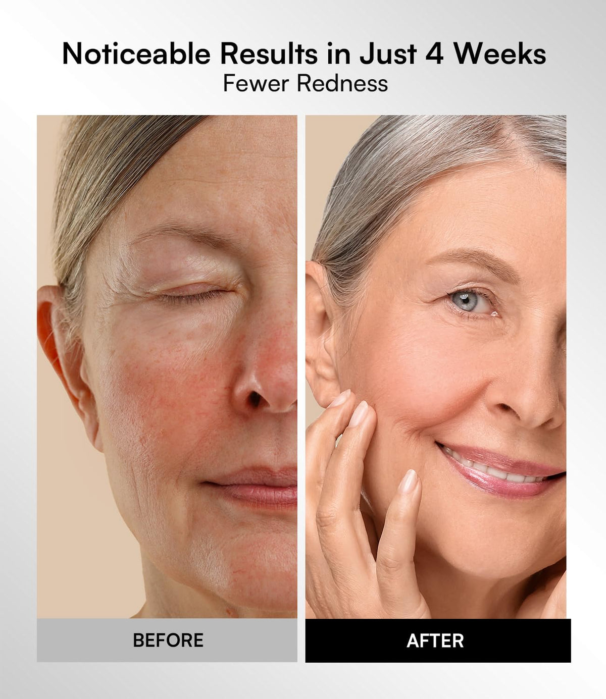 Transform Your Skin with the INIA Red Light Therapy Mask - 4 Modes of Healing Power, Visible Results in Just 4 Weeks!