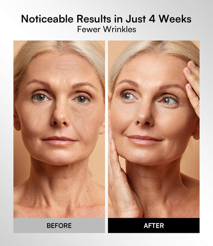 Transform Your Skin with the INIA Red Light Therapy Mask - 4 Modes of Healing Power, Visible Results in Just 4 Weeks!